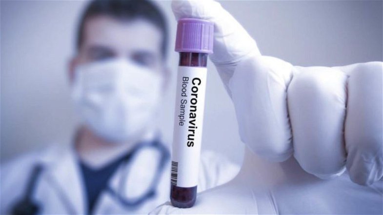Coronavirus, per il 3° giorno rallenta la crescita dei contagi ma nuovo aumento dei decessi: 743 le vittime