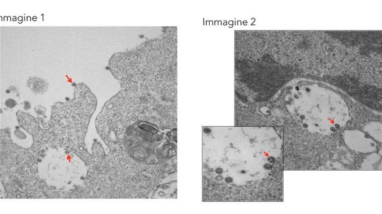 ULTIM'ORA - Covid-19: Ecco le prime foto del virus isolato in Lombardia