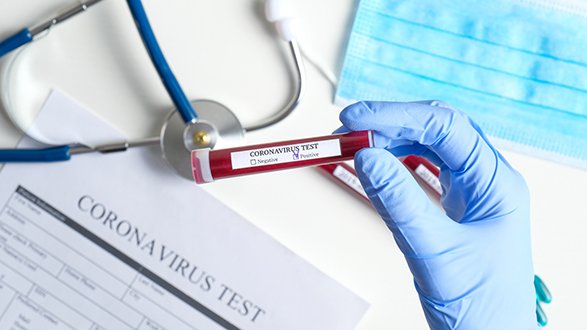 Coronavirus, test rapidi: utili o no? C'è chi dice sì