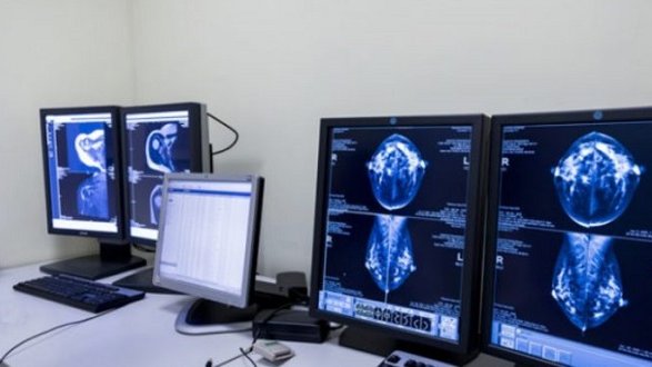 Cassano: sospeso il servizio di radiologia al poliambulatorio