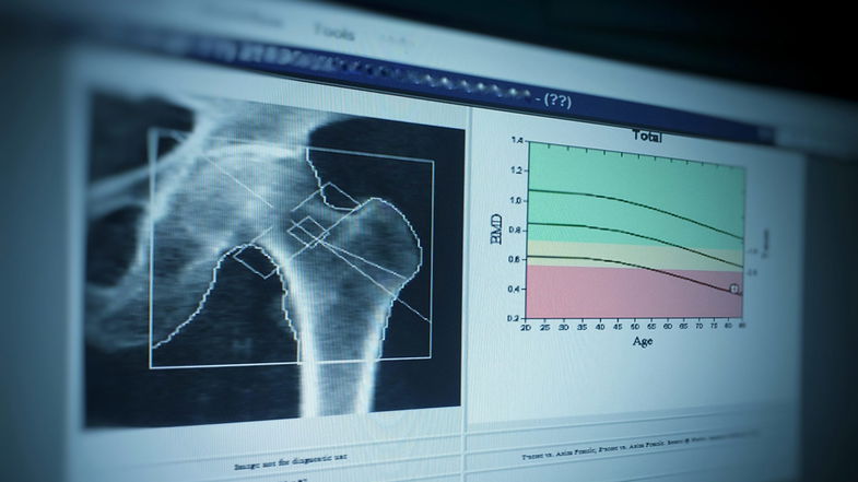 Disagi in Radiologia al Poliambulatorio di Cassano Jonio: non si possono effettuare Moc