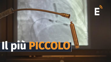 Impiantato a Castrovillari il pacemaker più piccolo al mondo