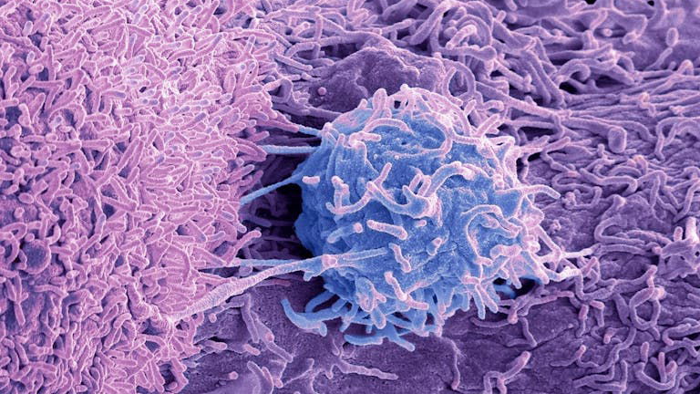 Campagna di prevenzione del tumore alla prostata. Primo appuntamento a Cosenza